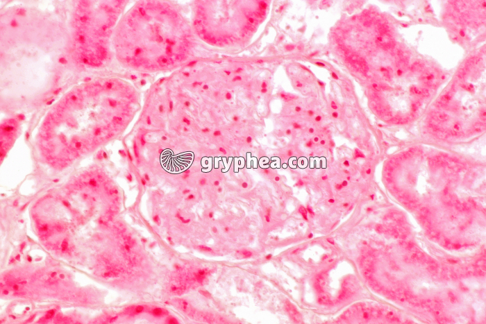 Rejet greffe de rein x150 - gryphea.org